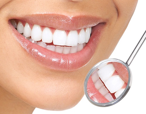 Bọc răng sứ ở đâu hiệu quả lâu dài tại Hà Nội?