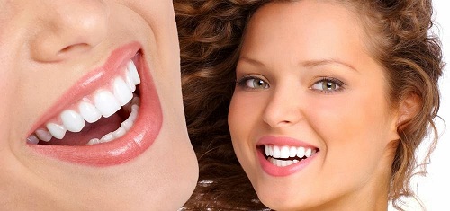 Những điều cần lưu ý khi đắp răng sứ để đảm bảo chất lượng