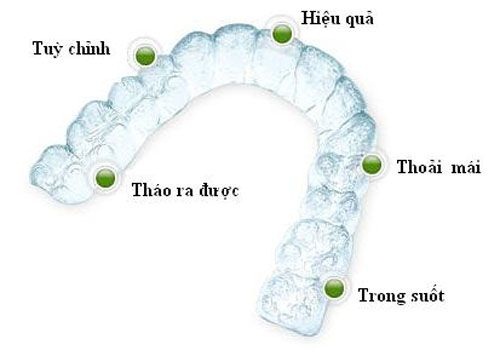 Niềng răng Invisalign giá bao nhiêu là rẻ nhất tại Hà Nội 