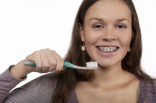 Sửa răng hô bằng phương pháp niềng răng chỉnh hình cần lưu ý gì?